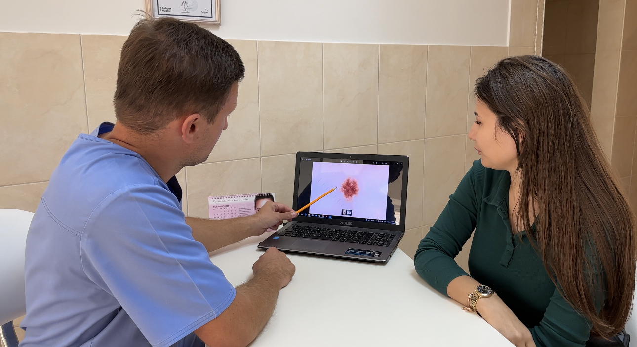 dermatoscopie_nevus_chisinău