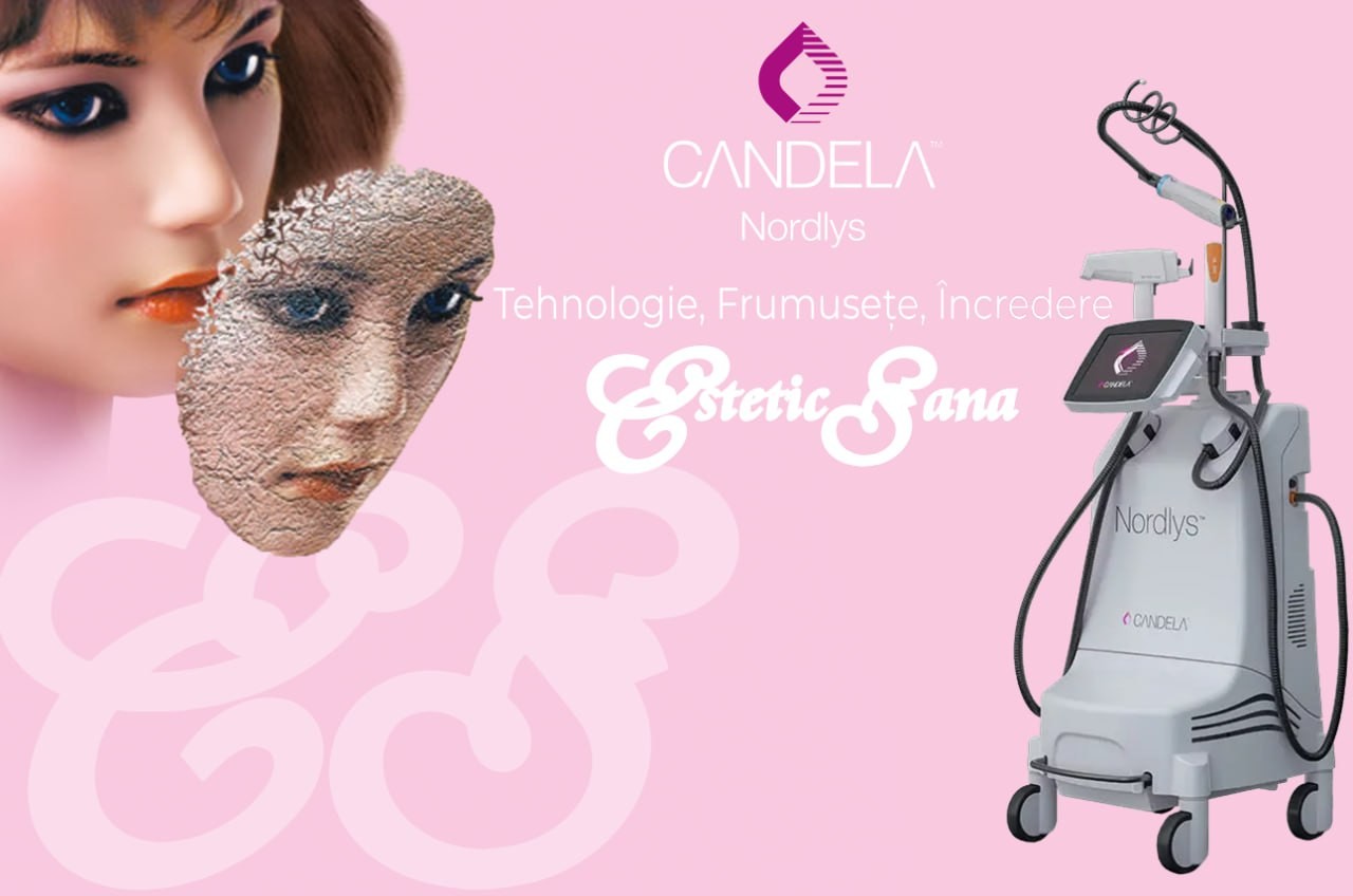 laser_candela_estetic_sana