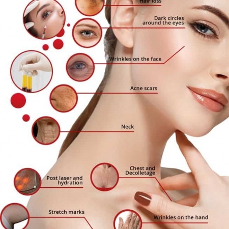 prp_terapie_clinica_estetic_sana