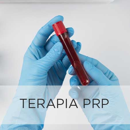 terapia_prp_esteticsana