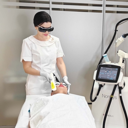 dr_diana_munteanu_candela_hiperpigmentatii